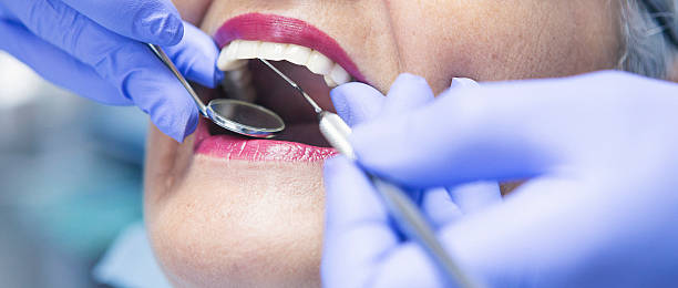 Best Knocked-Out Tooth (Avulsed Tooth) Treatment in Eddington, PA